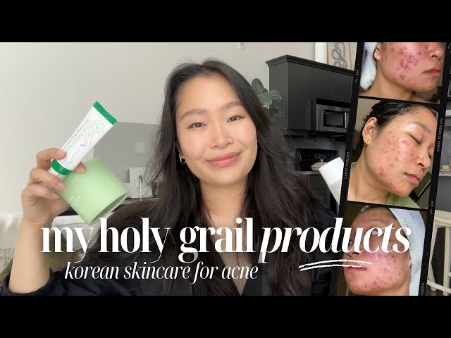 my updated HOLY GRAIL skincare products | how I heal active breakouts, adult acne, and scarring