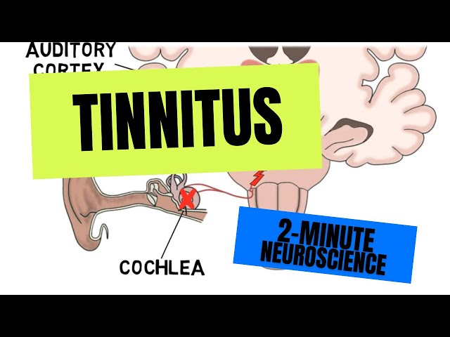 2-Minute Neuroscience: Tinnitus
