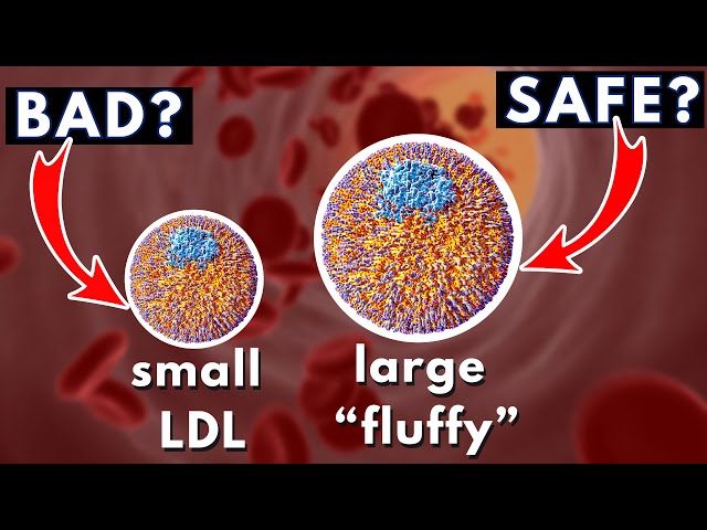 LDL size and Heart Disease (small dense vs large "fluffy") | Dr. William Cromwell
