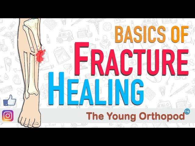 Fracture Healing | ANIMATION | BASICS | The Young Orthopod