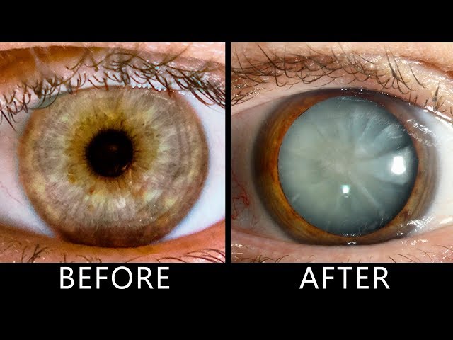 What Happens If You Don't Blink for 30 Days?