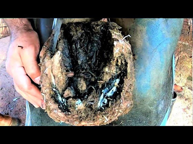 A dried Abscess with a Piece of iron inside ...