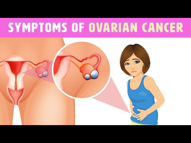 4 Ovarian Cancer Symptoms That Every Woman Needs To Know