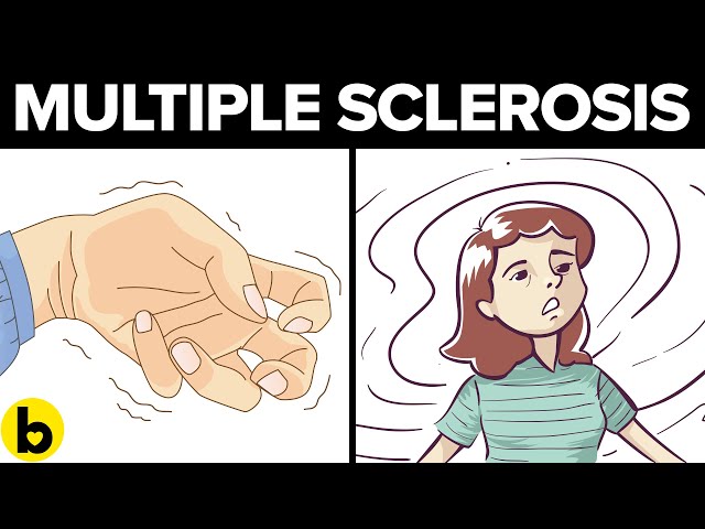 9 Symptoms Of Multiple Sclerosis You Need To Know About