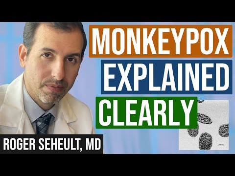 Monkeypox Explained Clearly