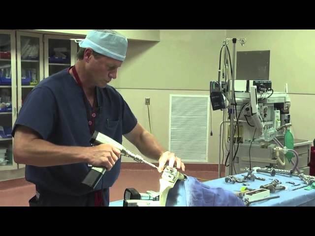 Total Knee Replacement Surgery Demonstration - Dr. Eric W. Janssen