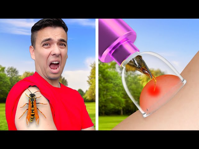 AMAZINGLY WEIRD EMERGENCY TIPS & TRAVEL HACKS| SURVIVAL GUIDE BY CRAFTY HACKS SHORTS