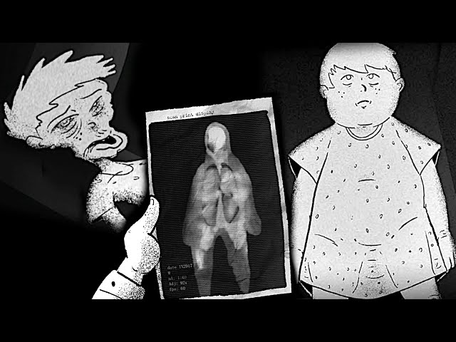 Body Horror Game Where A Boy Visits A Weight Loss Clinic & Loses Everything - Bad Faith