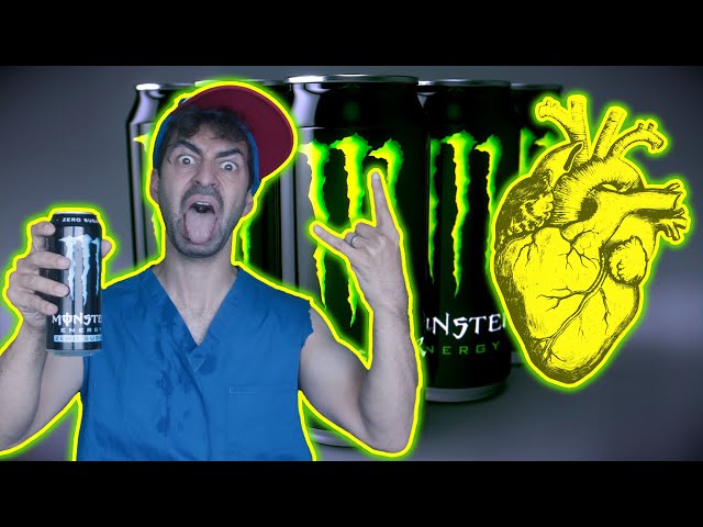 A Student Drank 2L Of Energy Drink A Day. This Is What Happened To His Heart