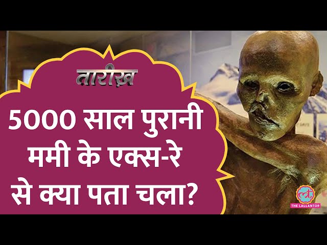 5000 साल पुरानी Mummy के एक्स-रे  से क्या पता चला? | Otzi the Iceman | Tarikh E555