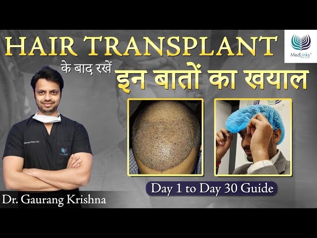 हेयर ट्रांसप्लांट के बाद क्या करे? After Hair Transplant Care in Hindi | Medlinks Hair Transplant