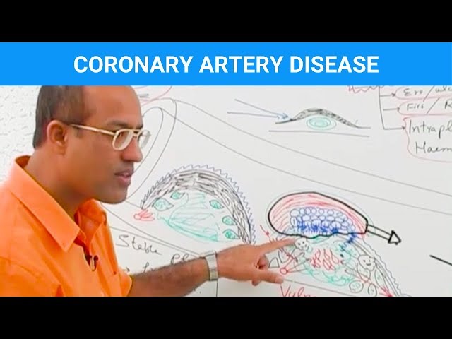 Coronary Artery Disease | Ischemic Heart Disease | Angina🫀