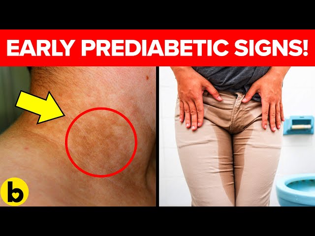 7 Early PREDIACBETIC Warning Signs You're Unaware Of