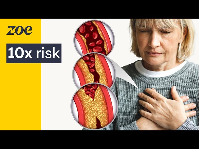 How to prevent heart disease, according to science | Prof. Eric Rimm
