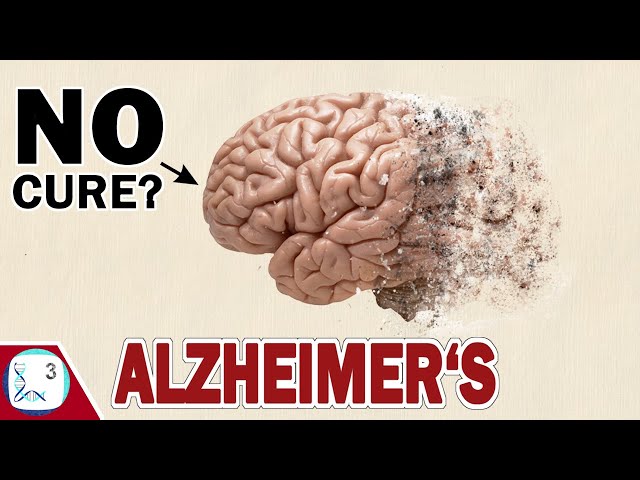 Curing Alzheimer's Disease is hard. But WE can do something..