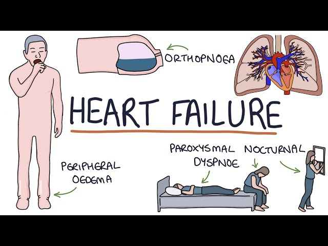 Understanding Heart Failure: Visual Explanation for Students
