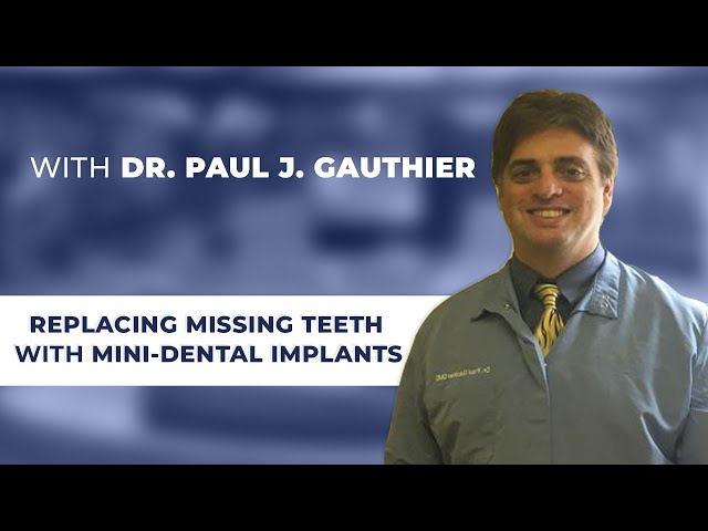 Replacing Missing Teeth with Mini-Dental Implants with Charlton, NY dentist Paul J. Gauthier, DMD