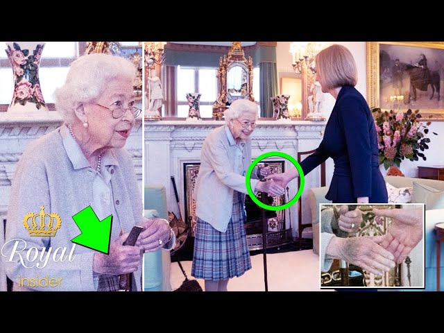 The Queen's nasty bruise overshadows new PM Liz Truss appointment - Royal Insider