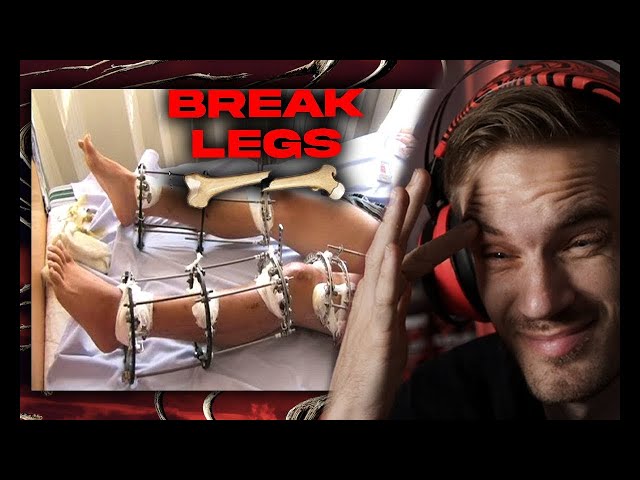 People break their legs on purpose. why?