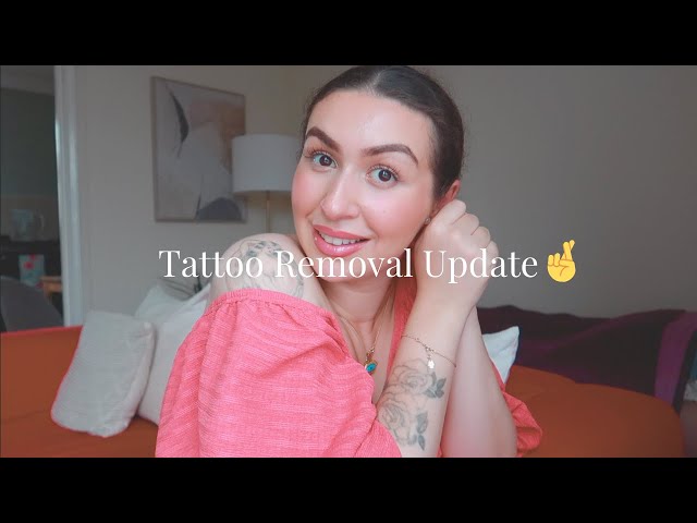 Laser Tattoo Removal Update! How are they looking?