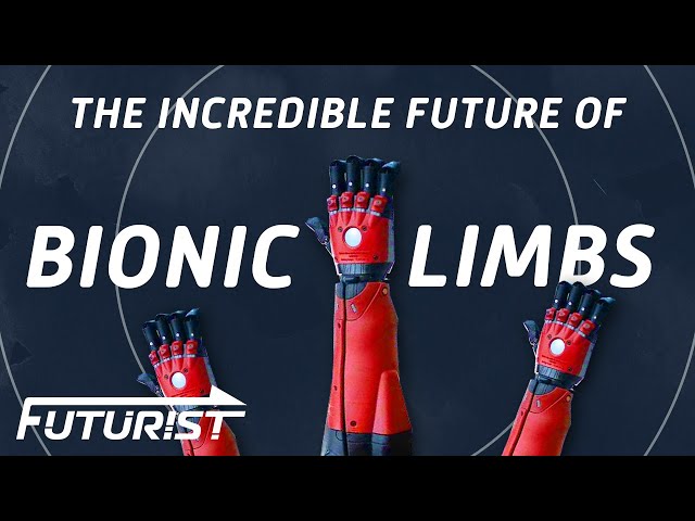 The Future Of Advanced Bionics
