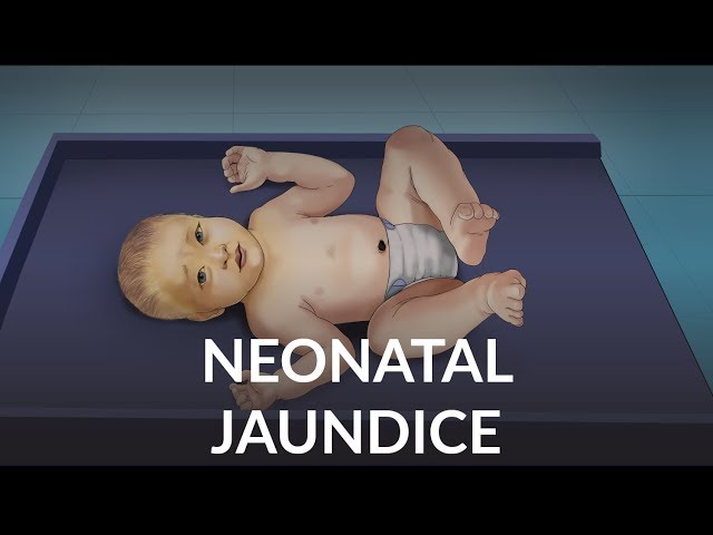 "Neonatal Jaundice" by Lauren Veit for OPENPediatrics