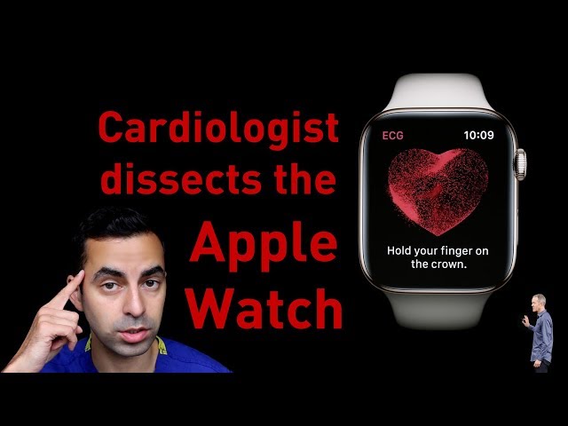 Cardiologist’s scientific analysis of the Apple Watch