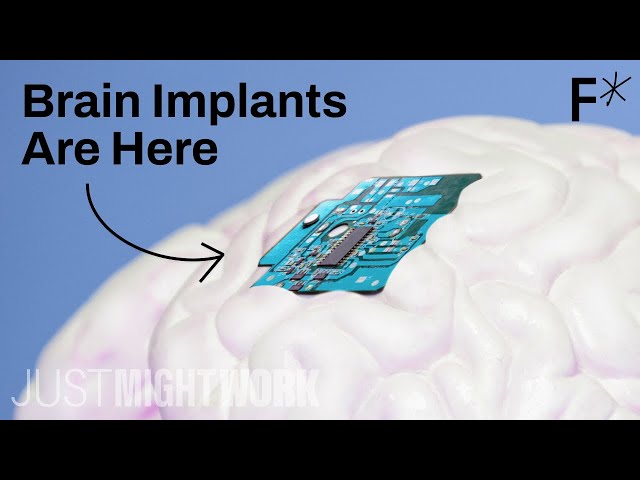 This implant can reverse paralysis. And that’s just the beginning. | Just Might Work