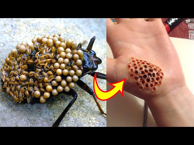 Top 10 Most Dangerous Bugs in the World