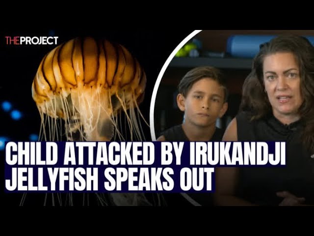 Child Attacked By Irukandji Jellyfish Speaks Out