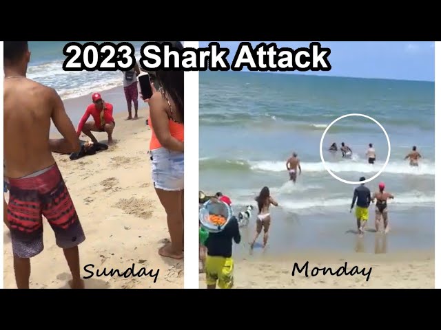 Shark Attacks Sever Two Teen's Limbs One Day Apart