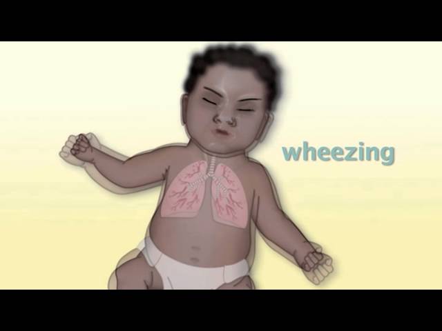 "Common Pediatric Respiratory Problems" by Monica Kleinman, MD for OPENPediatrics