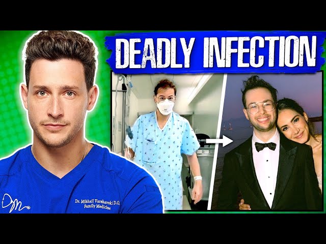 Doctor Reacts To Zach’s Hospitalization | Try Guys