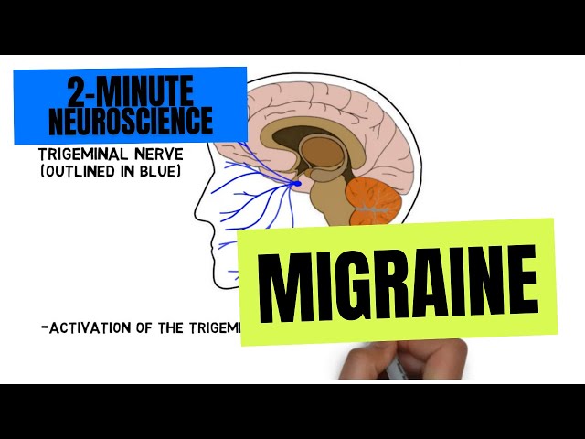 2-Minute Neuroscience: Migraine