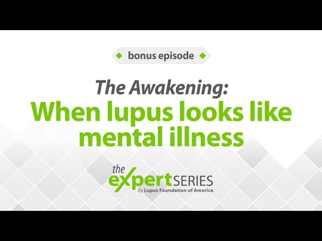 The Expert Series: The Awakening: When lupus looks like mental illness