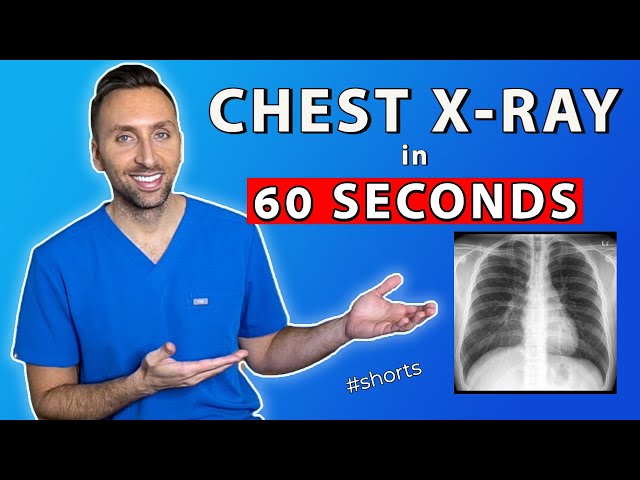 How to read a Chest X-ray in 1 Minute #shorts