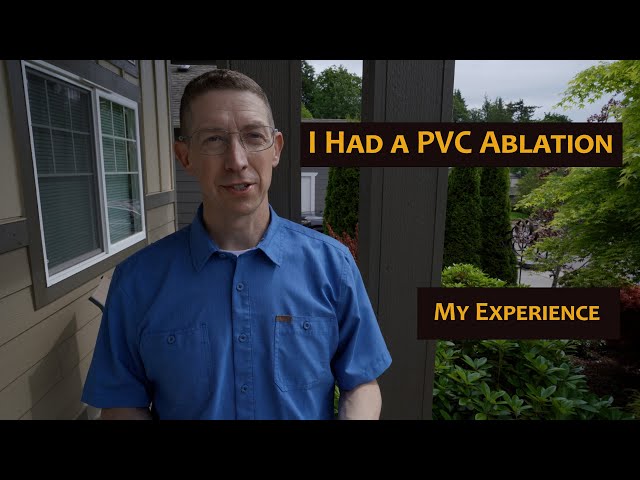 PVC Ablation - Patient Experience