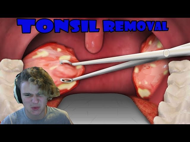 Don't Remember That Happening | Tonsil Surgery and Teeth Cleaning
