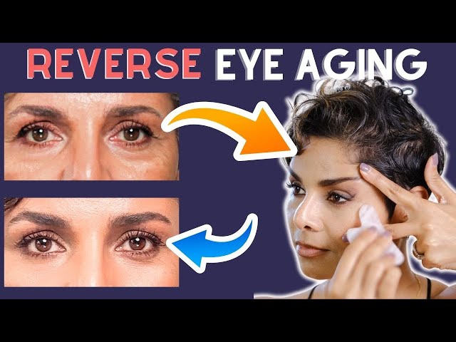 Dont Let EYE WRINKLES age you: Try Age Defying FACE YOGA and NATURAL REMEDIES