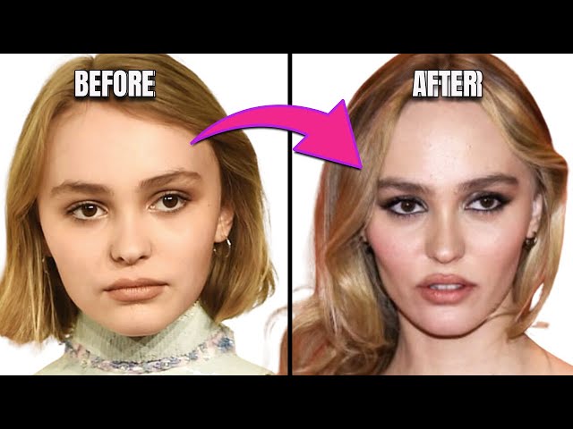 Has Plastic Surgery Prematurely Aged Lily Rose Depp?