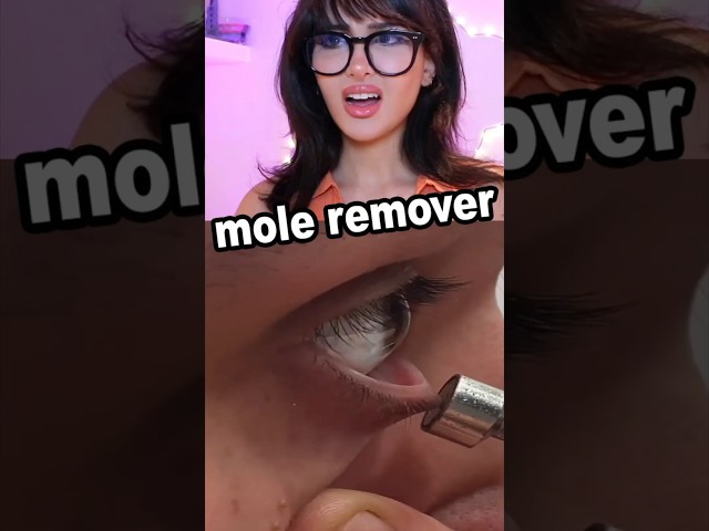 This Device Removes Moles!?
