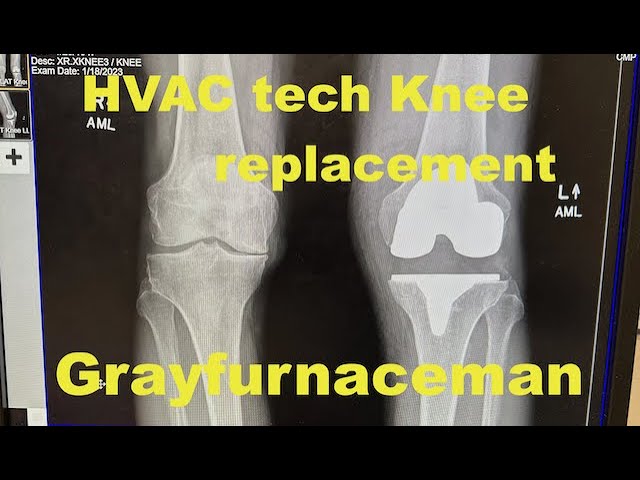 HVAC tech knee replacement part 2