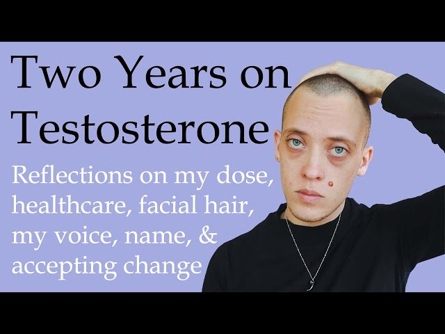 Two Years on Testosterone