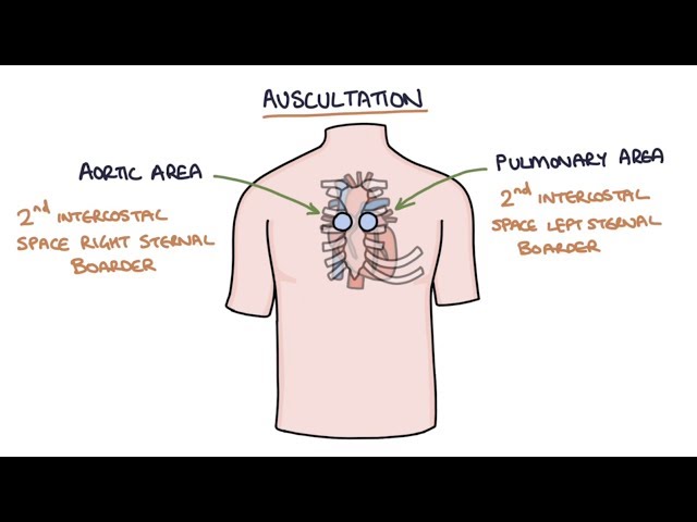 Heart Murmurs and Heart Sounds: Visual Explanation for Students