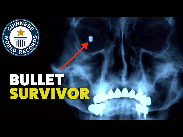 How Did He Survive This?! | Records Weekly - Guinness World Records
