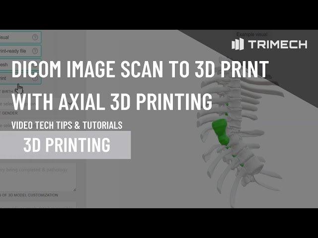 DICOM Image Scan to 3D Print with Axial 3D Printing