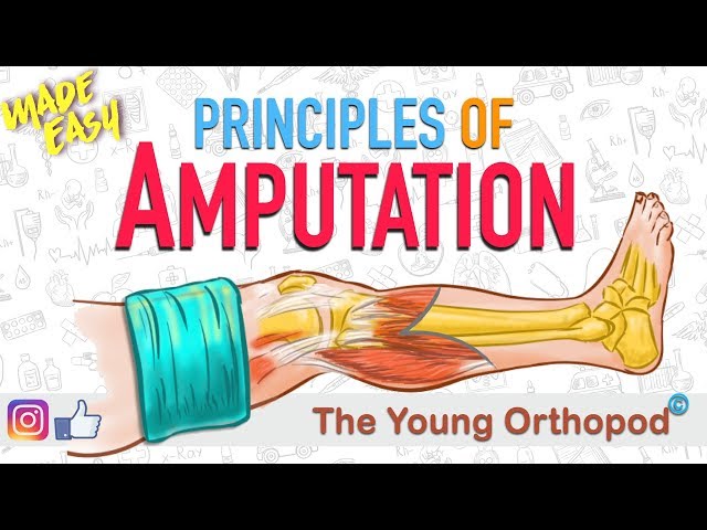Amputation Principles | ANIMATION | BASICS | NEET PG | Amputee - The Young Orthopod