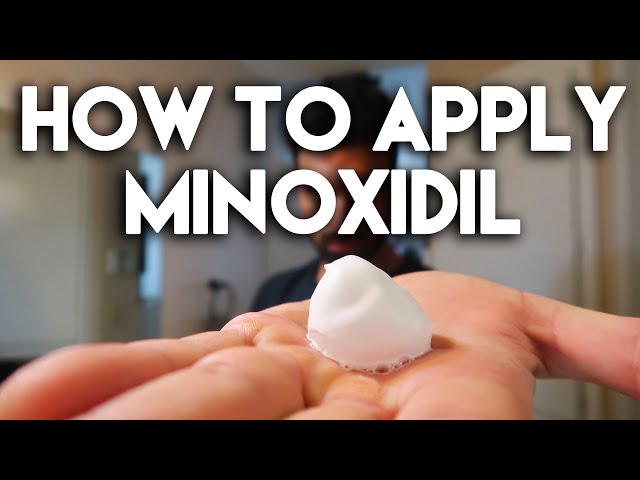 How to Apply Minoxidil (Rogaine)