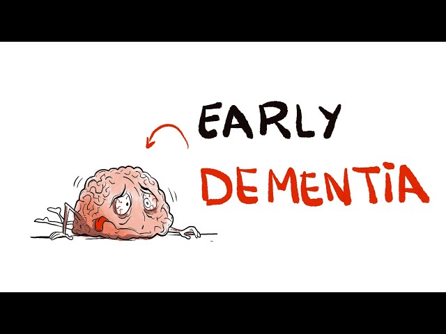 12 WARNING Signs of Dementia