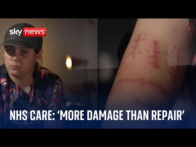Mental health patient says NHS care has done her more damage than repair